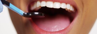 PRIX EXPÉDIENT D’UN PELISSE DENTAIRE EN ANTALYA EN ANTALYA